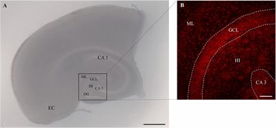 Microglia-Dependent and Independent Brain Cytoprotective Effects of Mycophenolate Mofetil During Neuronal Damage